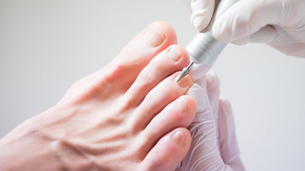 Комплексная обработка стопы