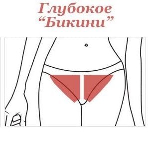 Лазерная эпиляция Бикини Глубокое