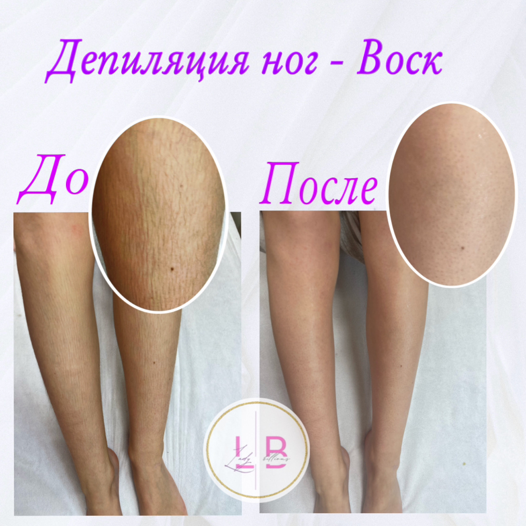 Депиляция ног полностью