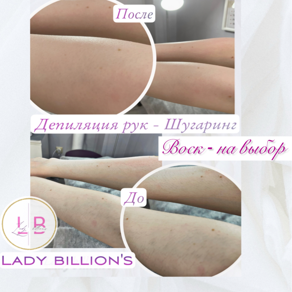 Депиляция рук  Воск / Сахар на выбор