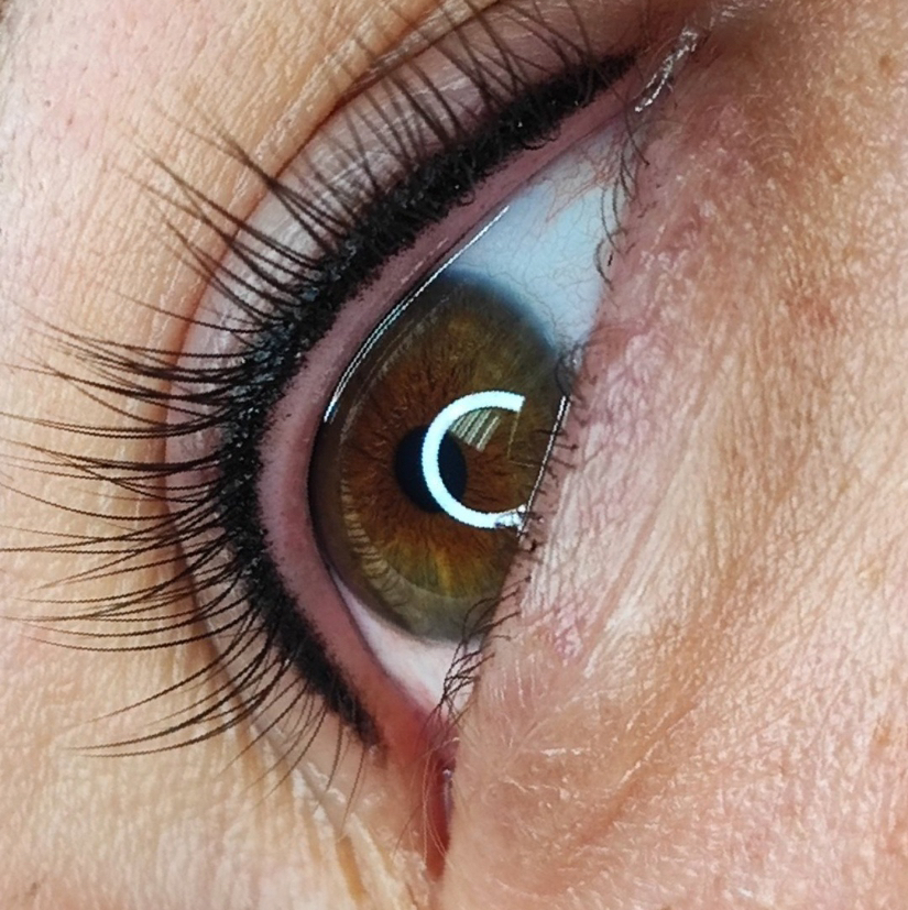 Заполнение межресничного пространства