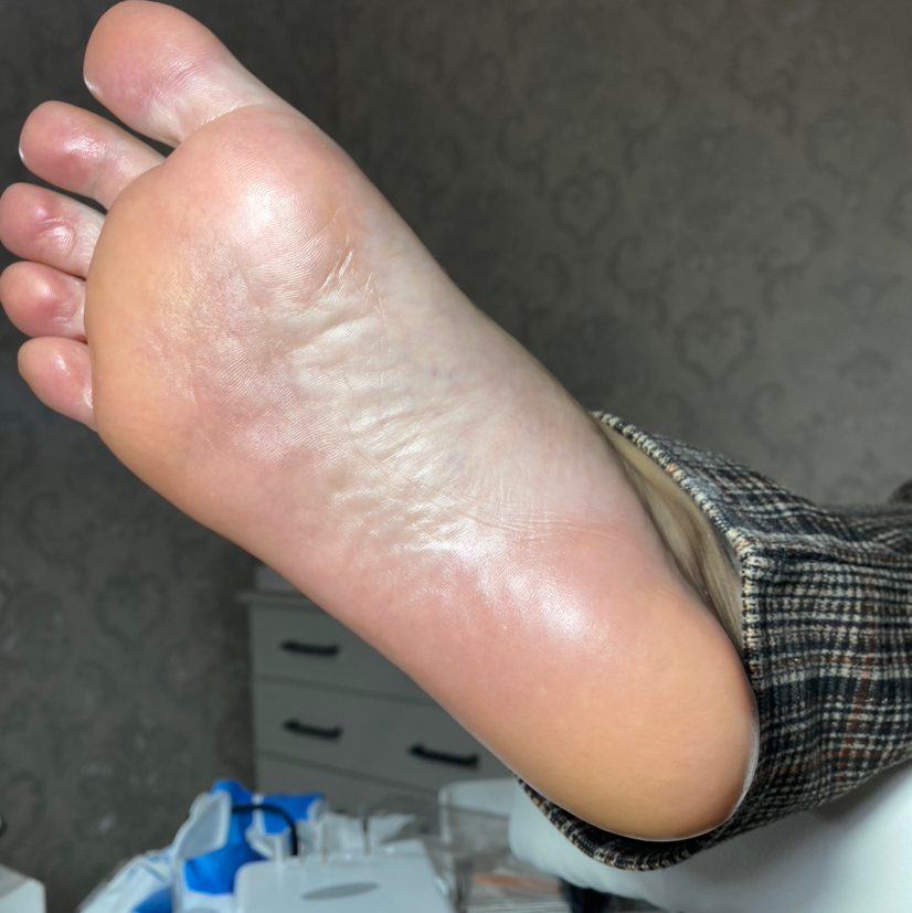 Обработка стоп