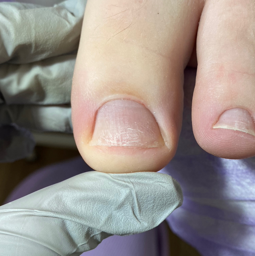 Обработка пальчиков