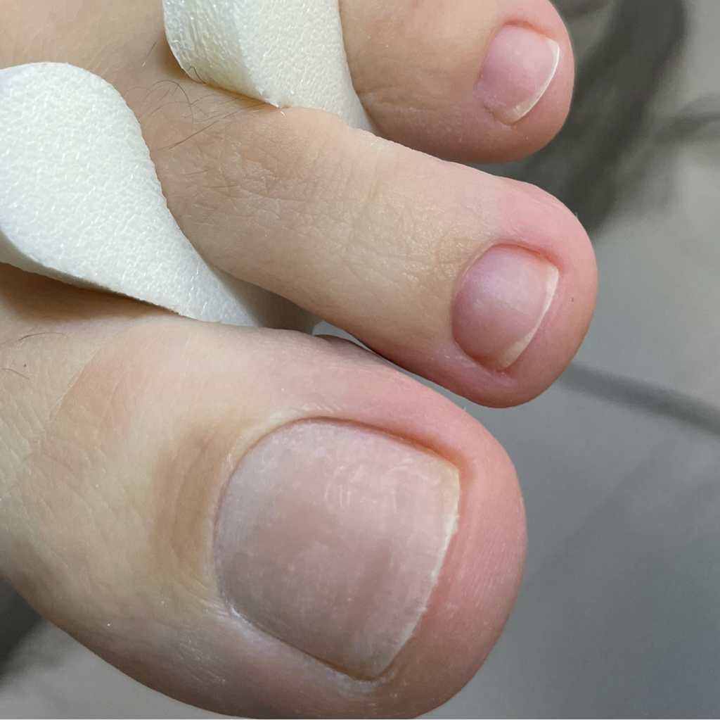 Педикюр гигиенический