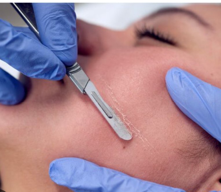 Dermaplaning (+mask, LED therapy)