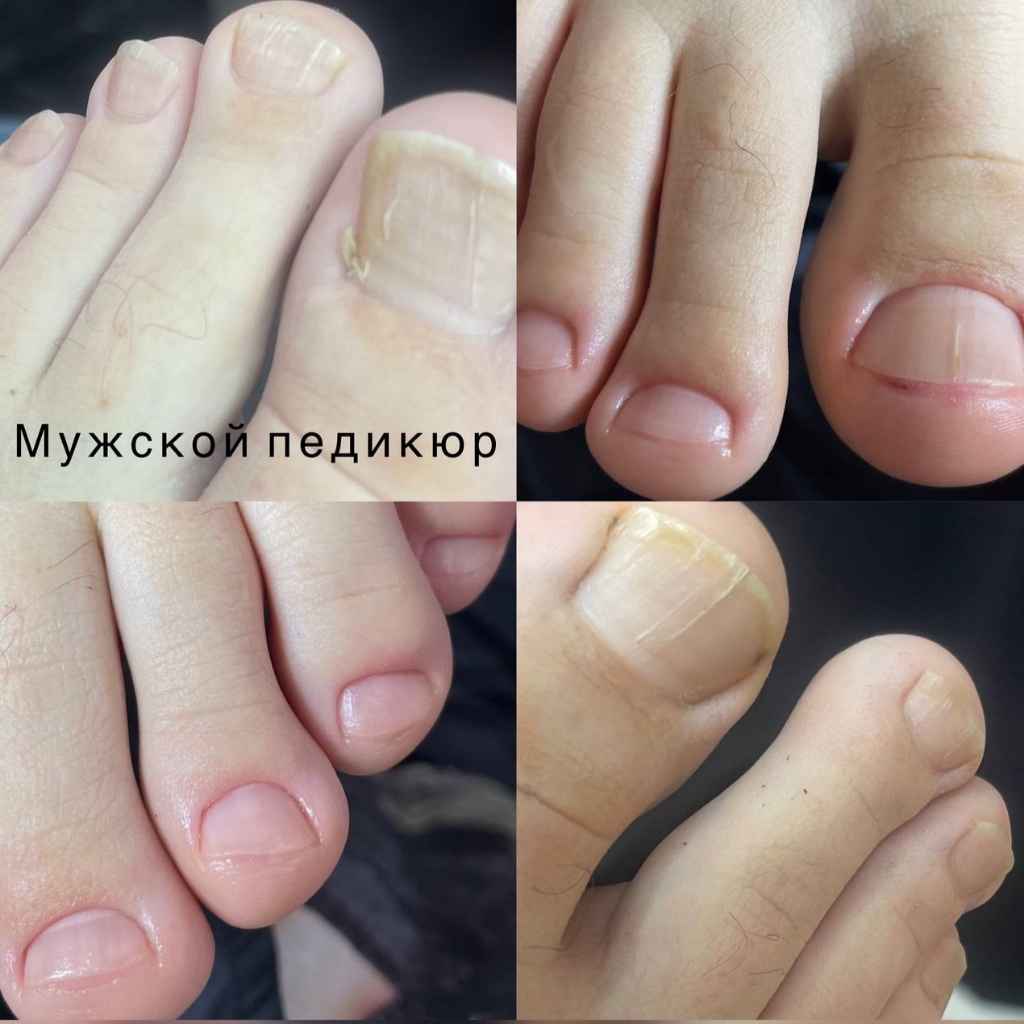 Аппаратный мужской педикюр