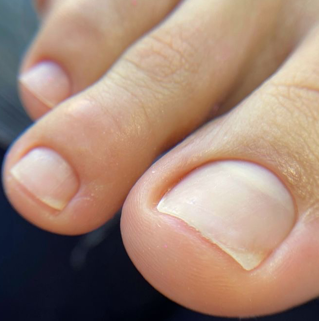 Гігієнічний Чоловічий педикюр - Hygienic pedicure for man