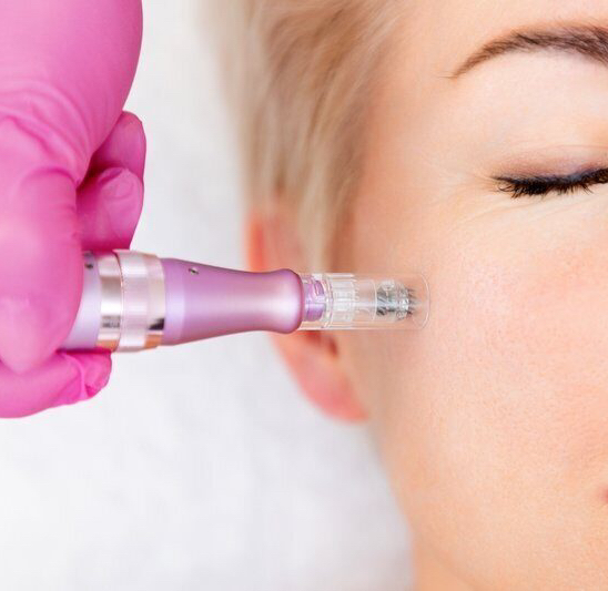 ФРАКЦИОННАЯ РЕВИТАЛИЗАЦИЯ