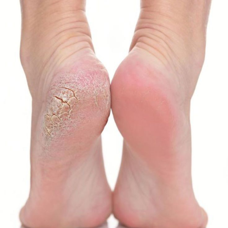 Педикюр Smart без покрытия