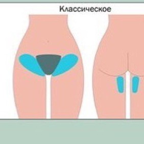 классическое бикини