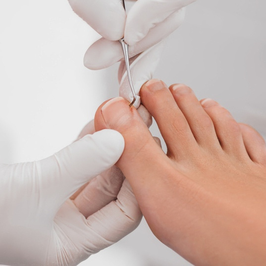 Парамедицинский педикюр