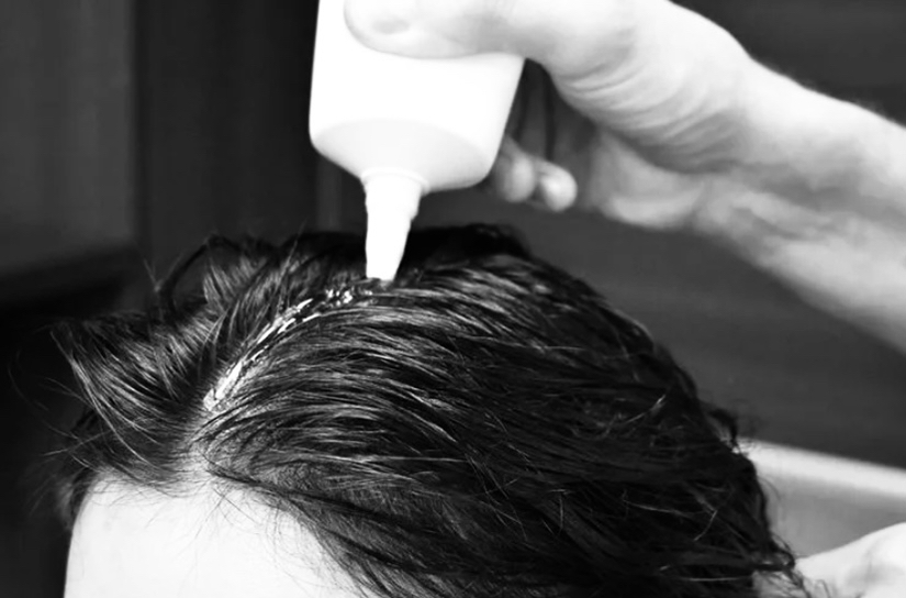 Пилинг кожи головы