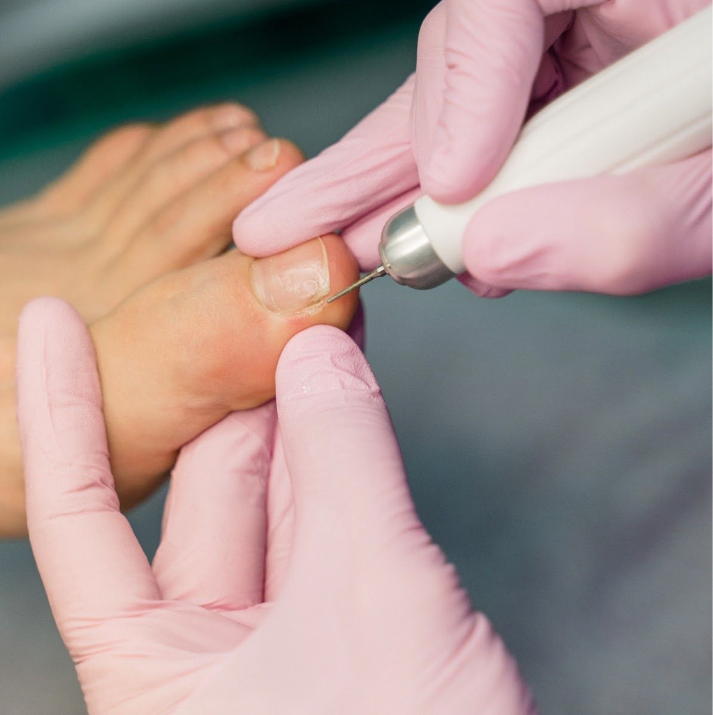 Медицинский педикюр без покрытия