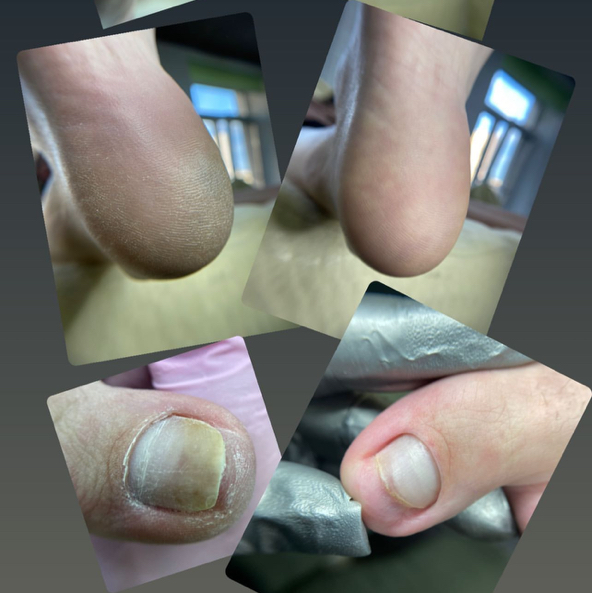 Педикюр Аппаратный-  Смарт (  полная обработка без покрытия )