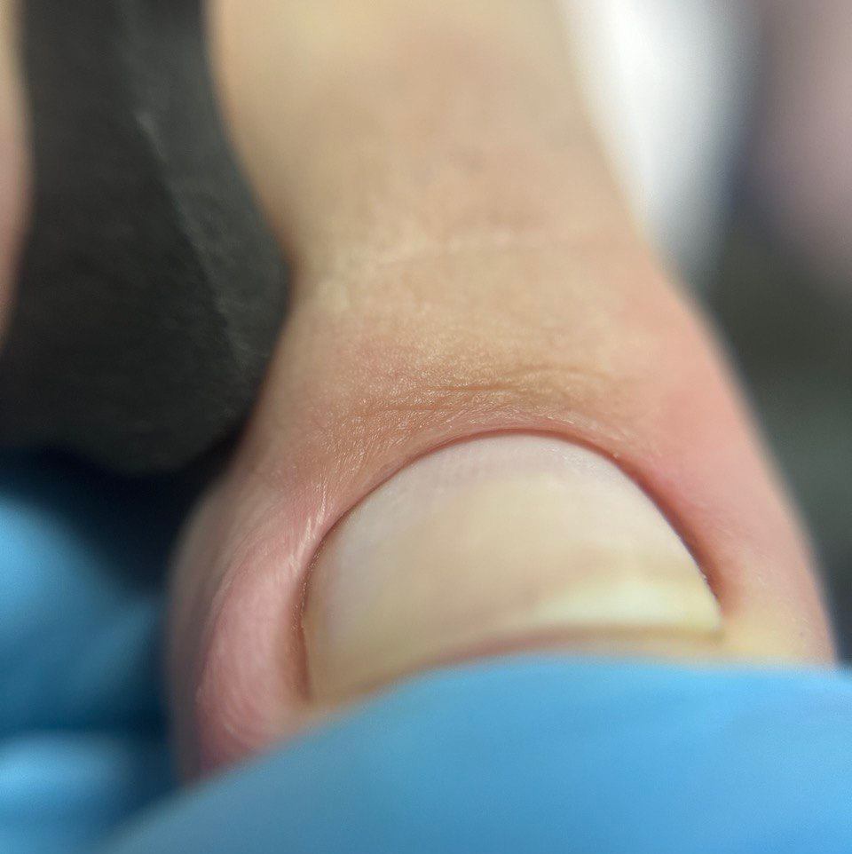 CLASSIC педикюр  (педикюр без покрытия+пяточки )