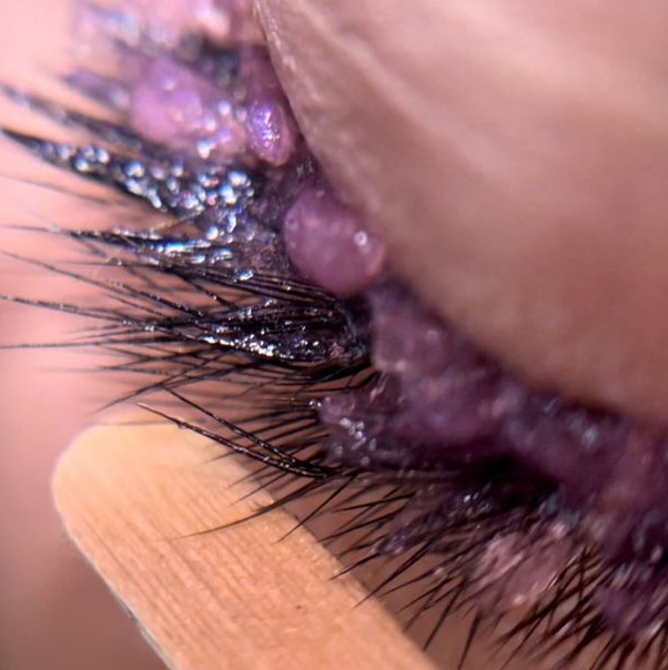 Снятие наращенных ресниц с последующим наращиванием