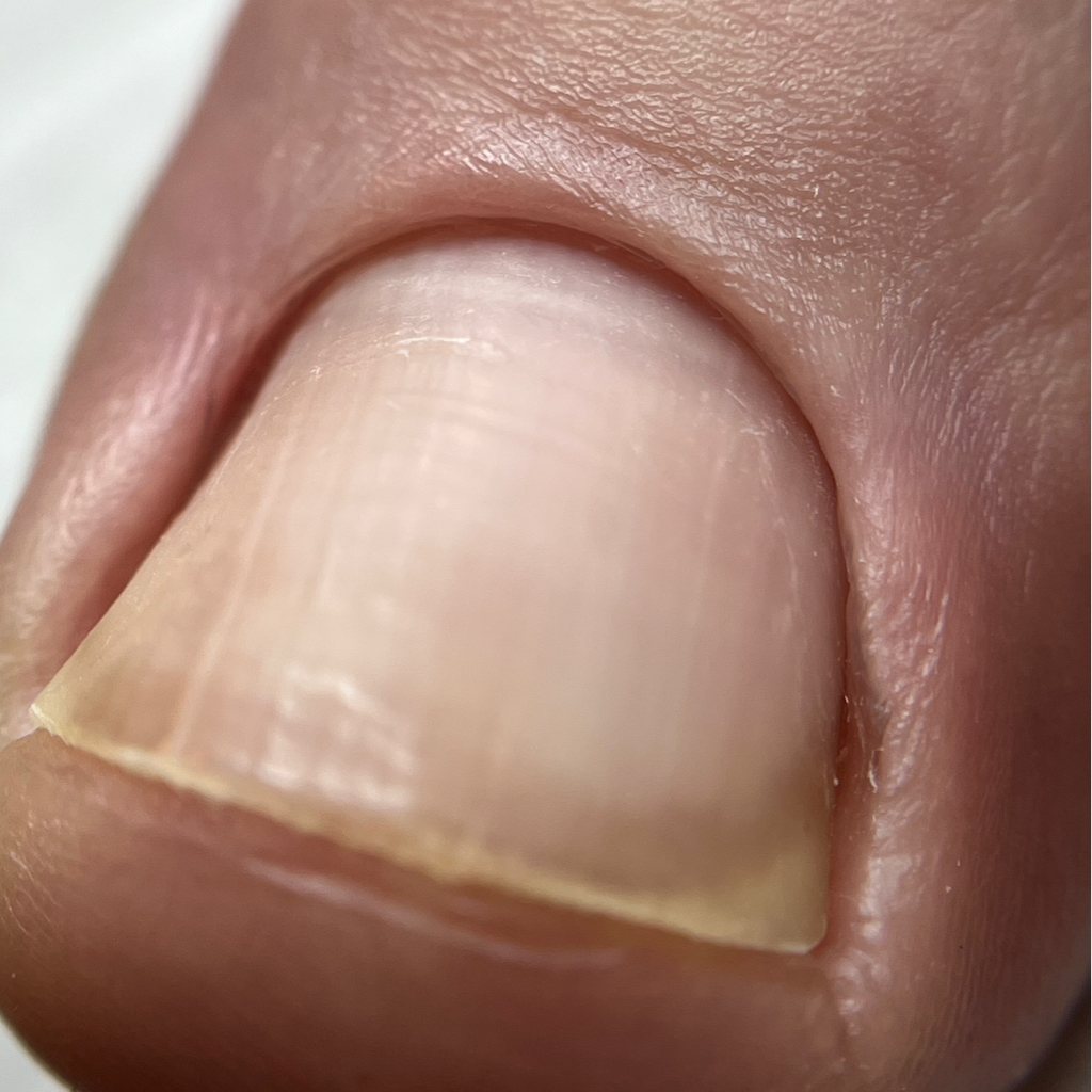 Гигиенический педикюр