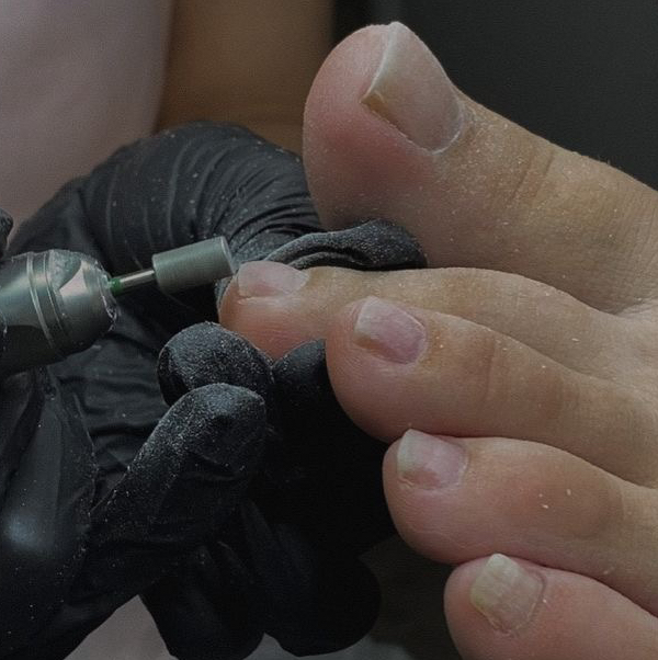 Педикюр аппаратный