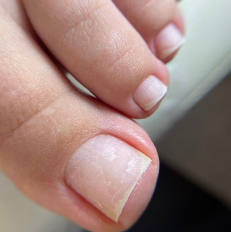 Педикюр обработка пальчиков