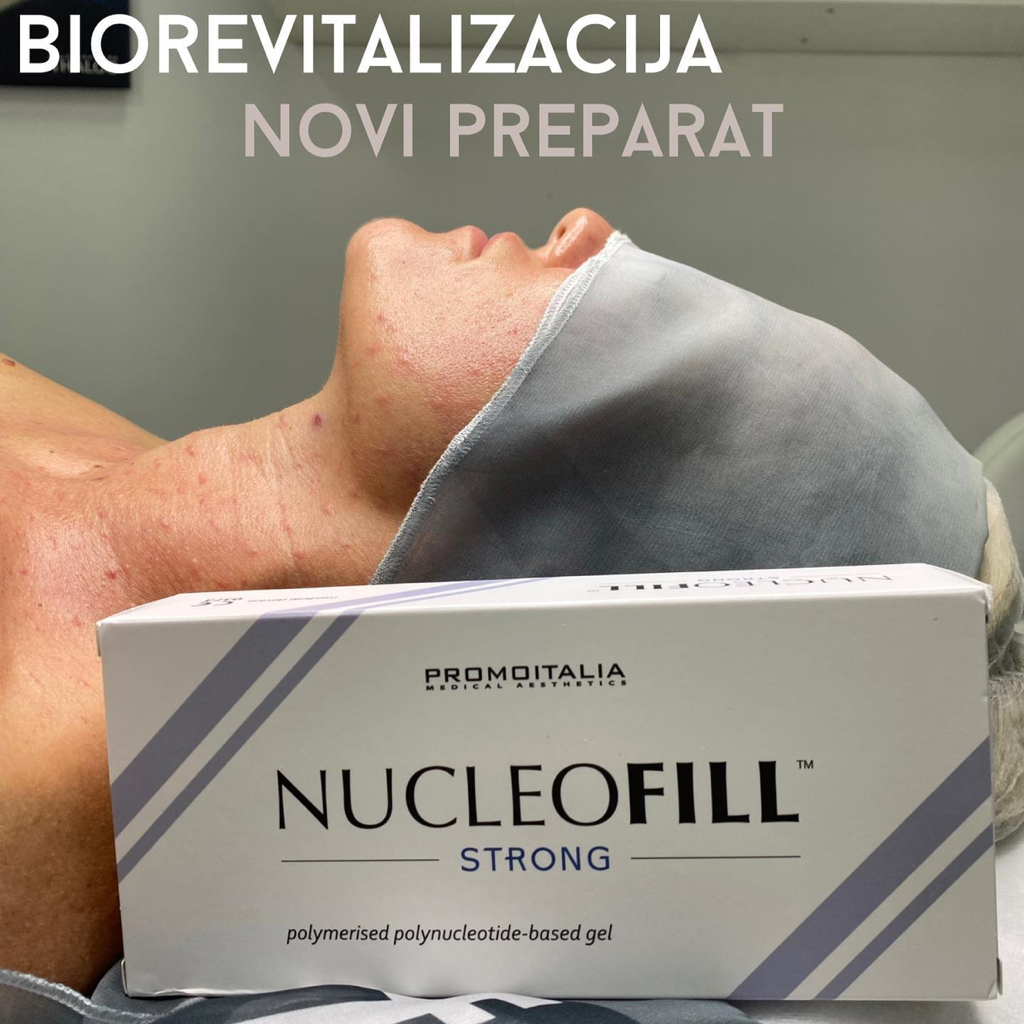 Biorevitalizacija Nucleofill Strong 1,5 ml