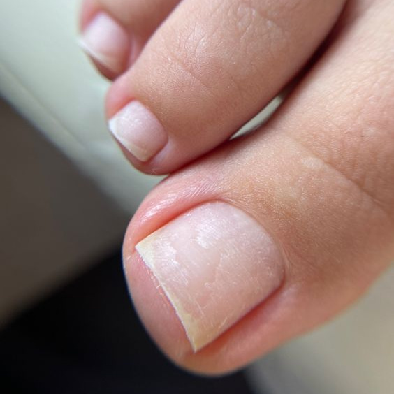 Педикюр гигиенический