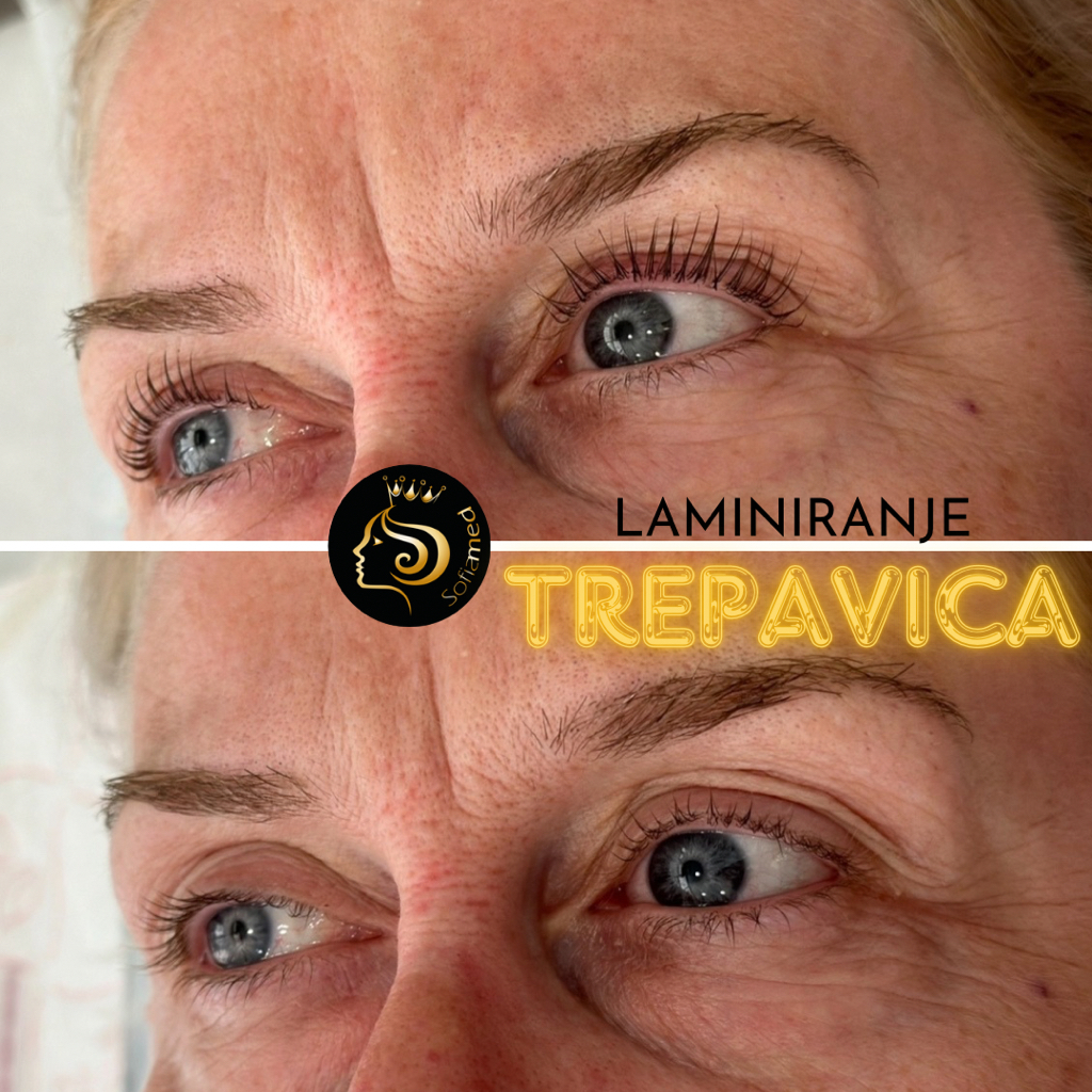 Laminiranje trepavica(Lash lift)