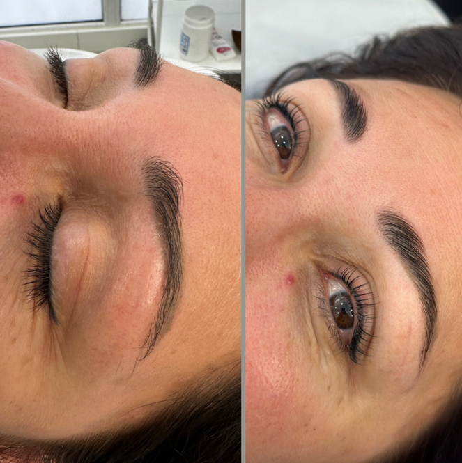 Laminiranje obrva(Brow lift)