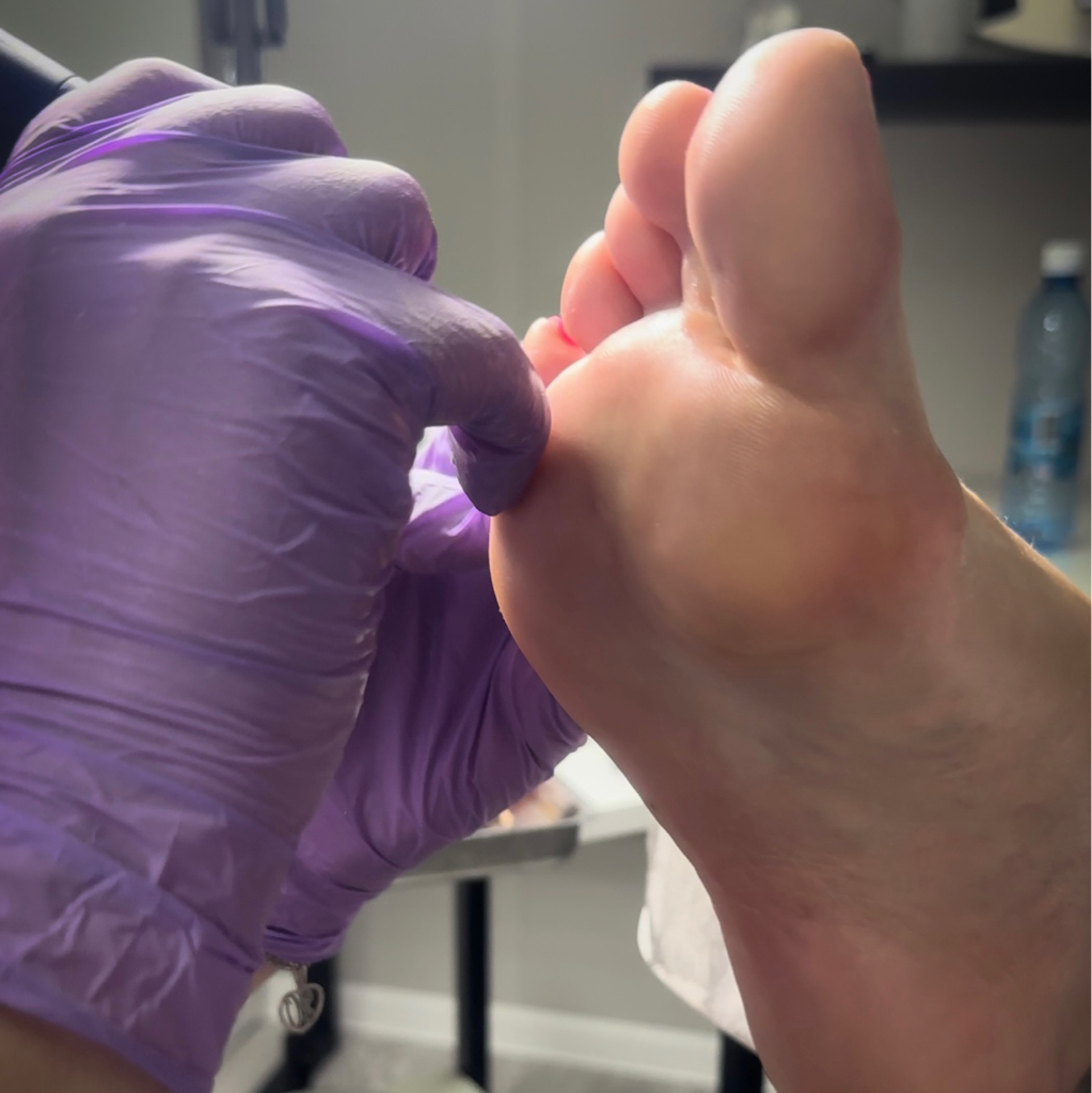 Педикюр Аппаратный