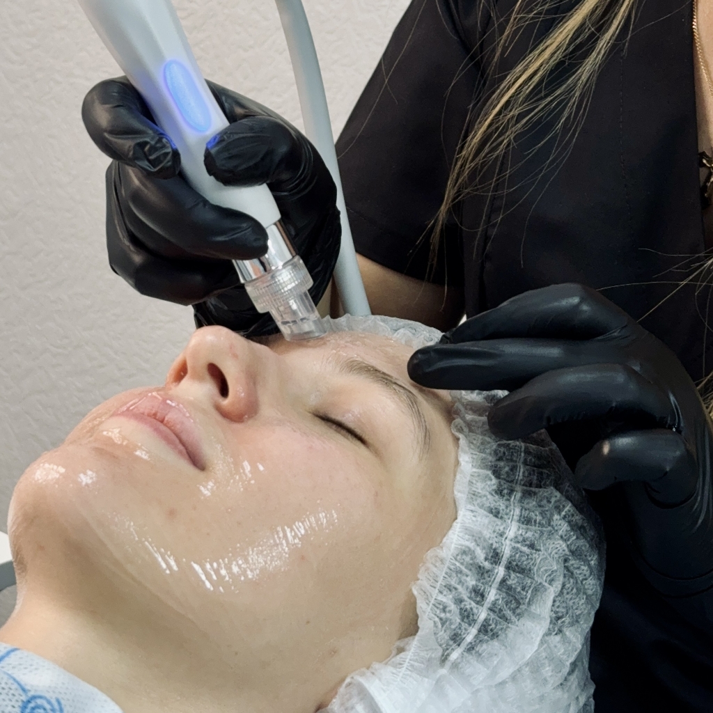 УЗ чистка лица