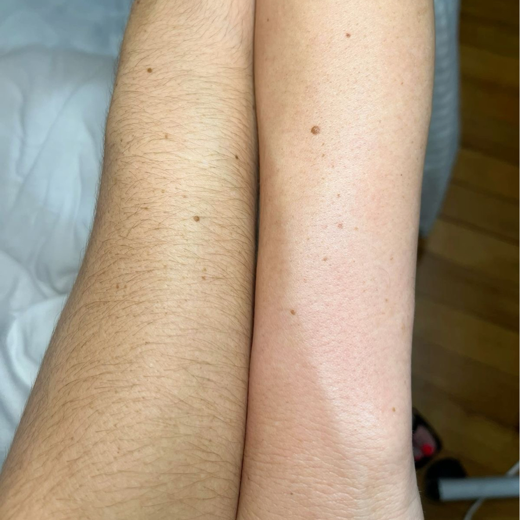 Руки полностью