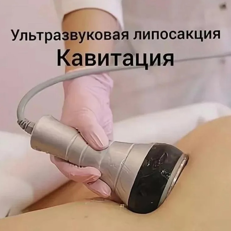 Кавитация