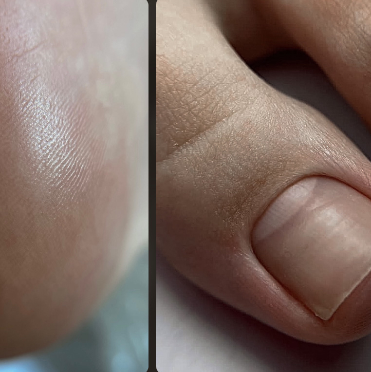 Гигиенический педикюр без покрытия (стопа+пальцы, снятие включено)  МАСТЕР