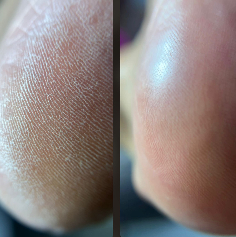 Мужской педикюр МАСТЕР