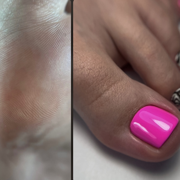 Гигиенический педикюр: обработка стопы и пальцев + покрытие цветным лаком/гель лаком МАСТЕР