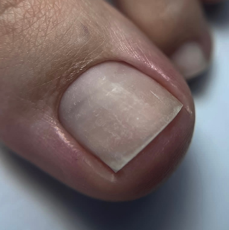 Обработка пальцев без покрытия МАСТЕР