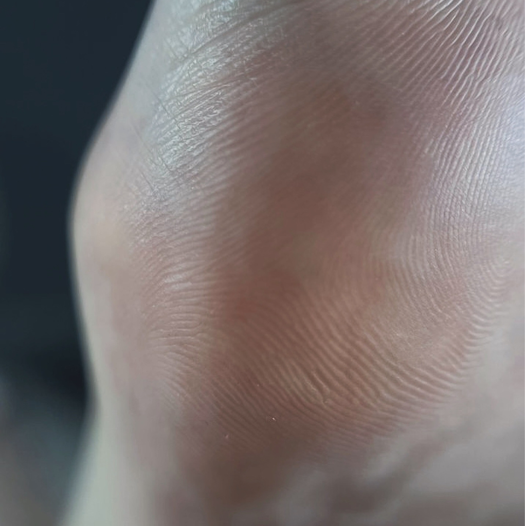 Обработка стопы МАСТЕР