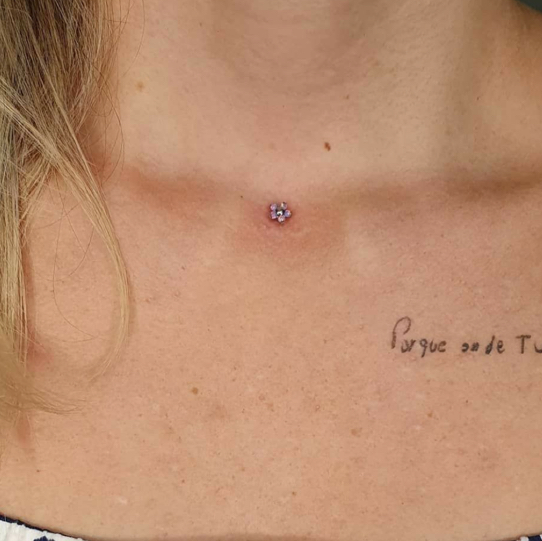 Микродермал