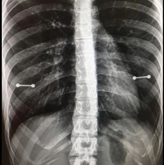 Пирсинг сосков (1/2)