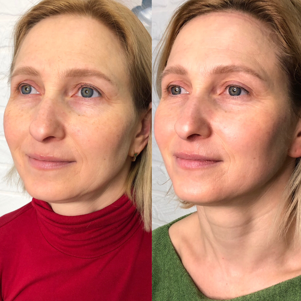 Массаж лица с глубоким уходом (разово)