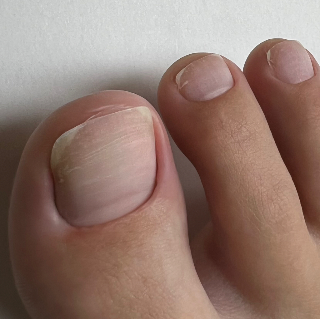 Экспресс- педикюр