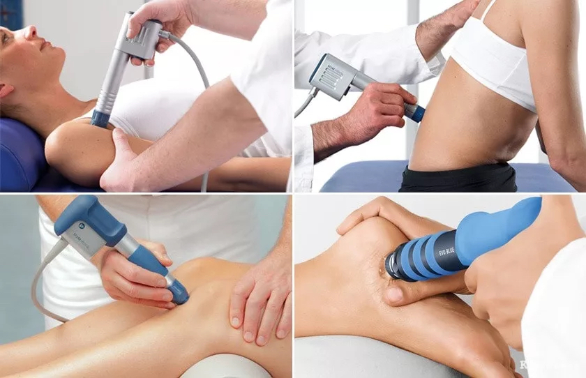 УВТ - УДАРНО-ВОЛНОВАЯ ТЕРАПИЯ (5 сеансов в пакете) оплата пакета на ПЕРВОМ сеансе