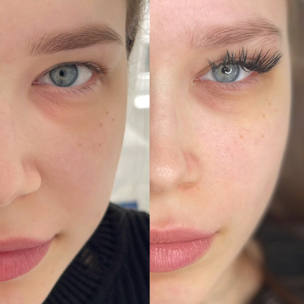 Обновление цвета от 1 года до 2-х лет