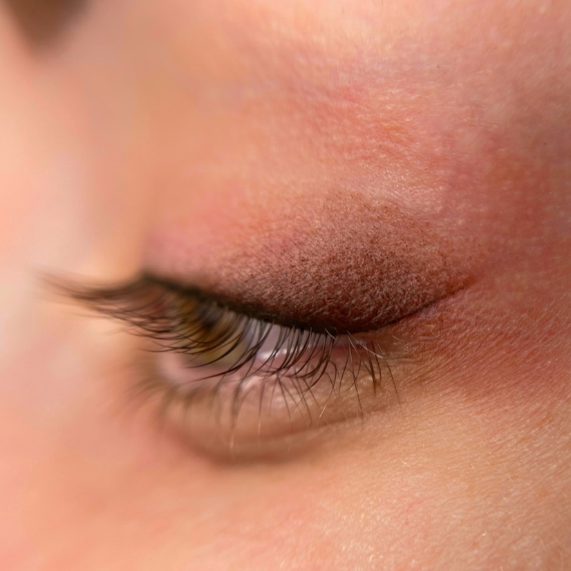 Межресничка