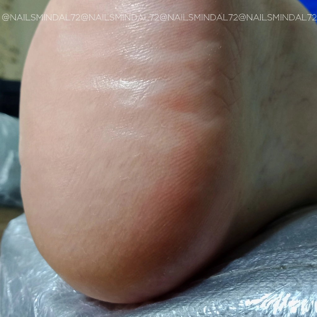 Педикюр гигиенический  без покрытия