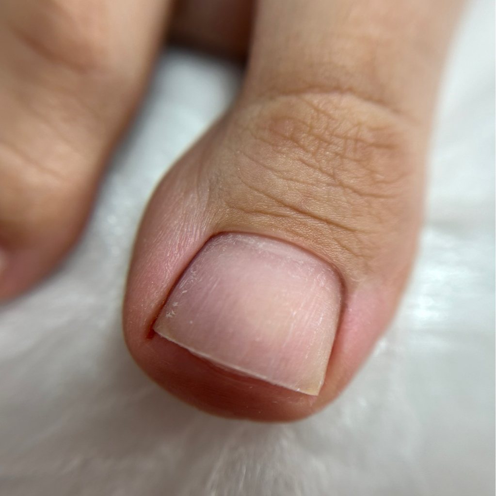 Обработка пальчиков ног без покрытия