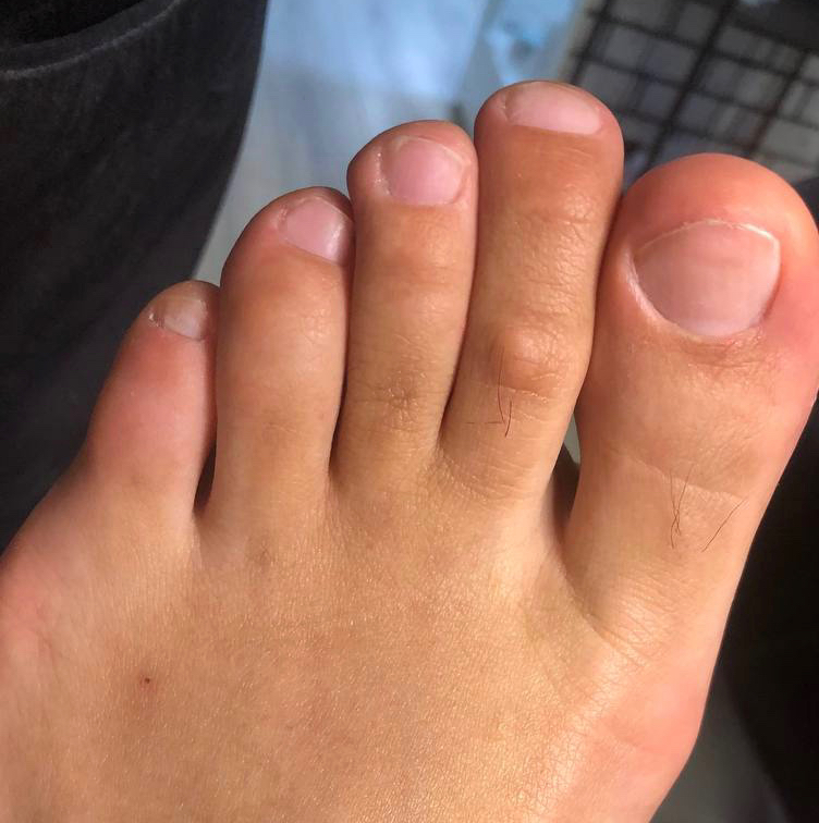 Мужской педикюр