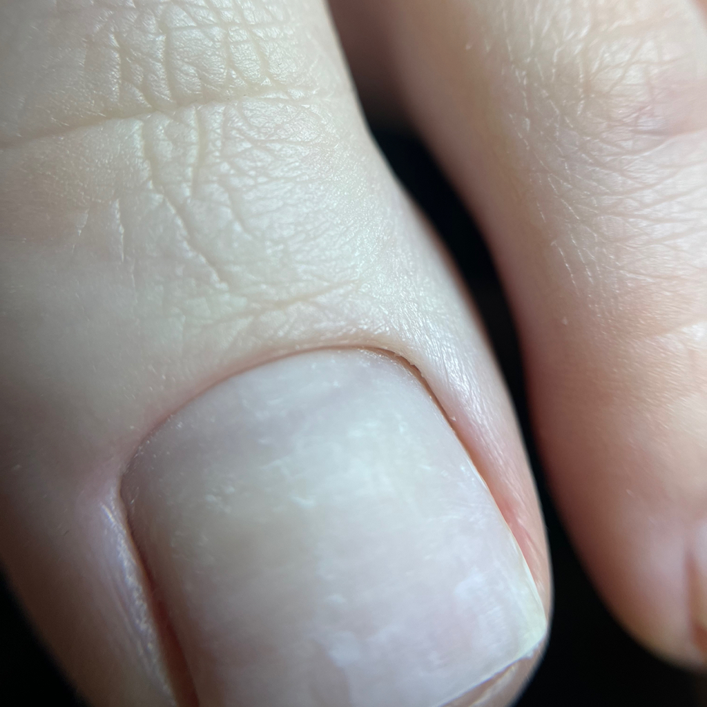 Smart без покрытия