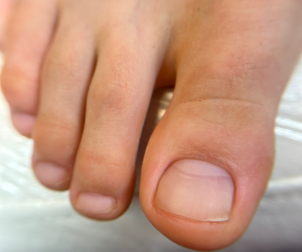 Педикюр, только пальчики без покрытия