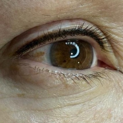 Перманент межресничного пространства