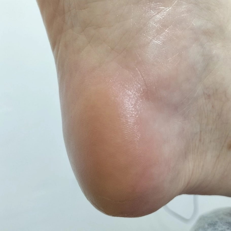 Педикюр без покрытия гель лаком